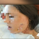 Illustration for article titled Gang Rape Victim With Multiple Sclerosis Says Police Ignored Her